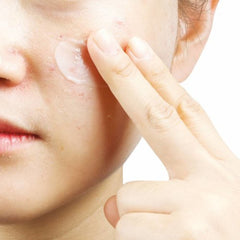 Anti-T Cream - koreanblossom