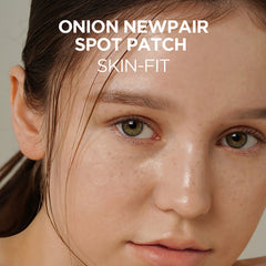 Onion Newpair Spot Patch Skin Fit - koreanblossom