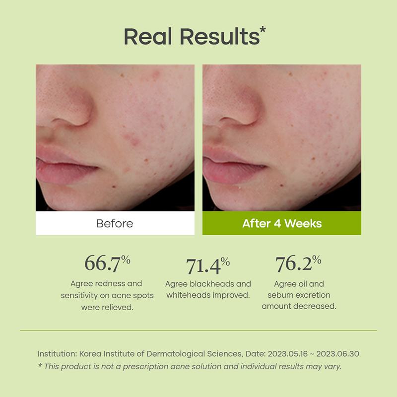 Clear Code Superfruit Serum - koreanblossom