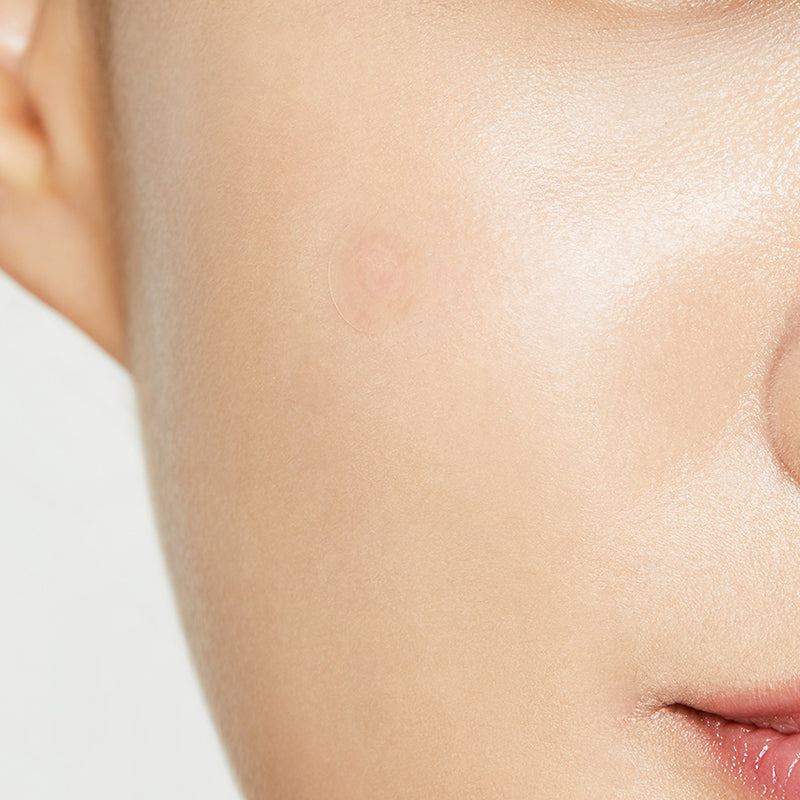 Clear Fit Master Patch - koreanblossom