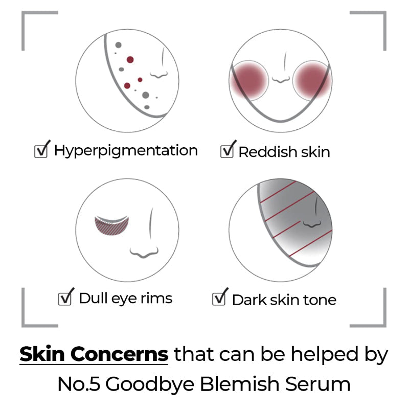 No.5 Goodbye Blemish Serum - koreanblossom