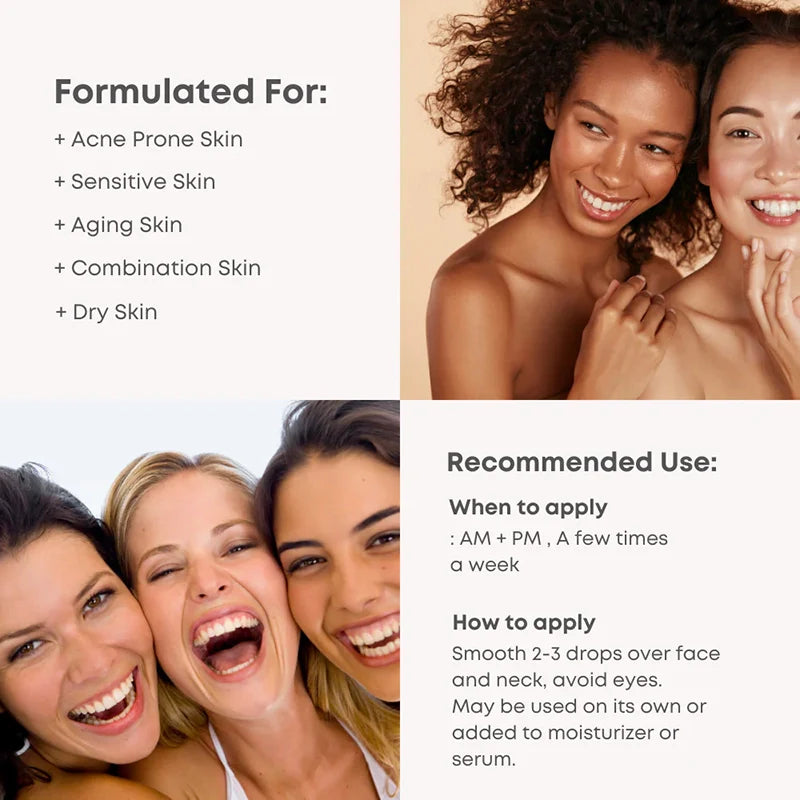 A-Control 10% Azelaic Acid Serum - koreanblossom