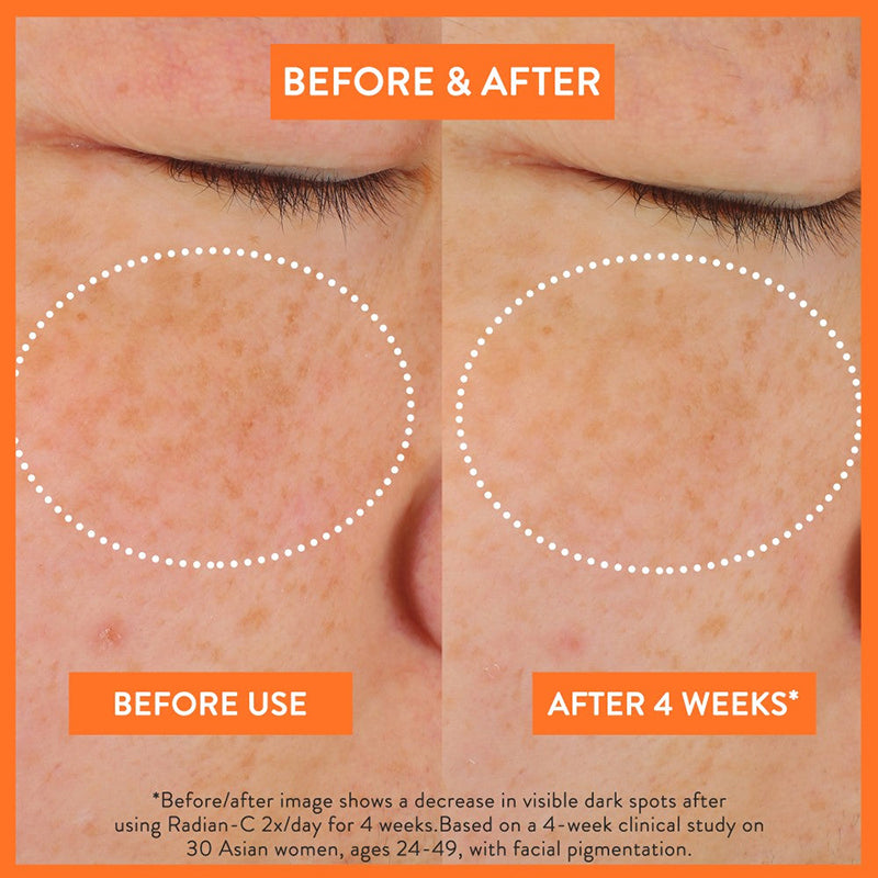 Radian-C Cream - koreanblossom