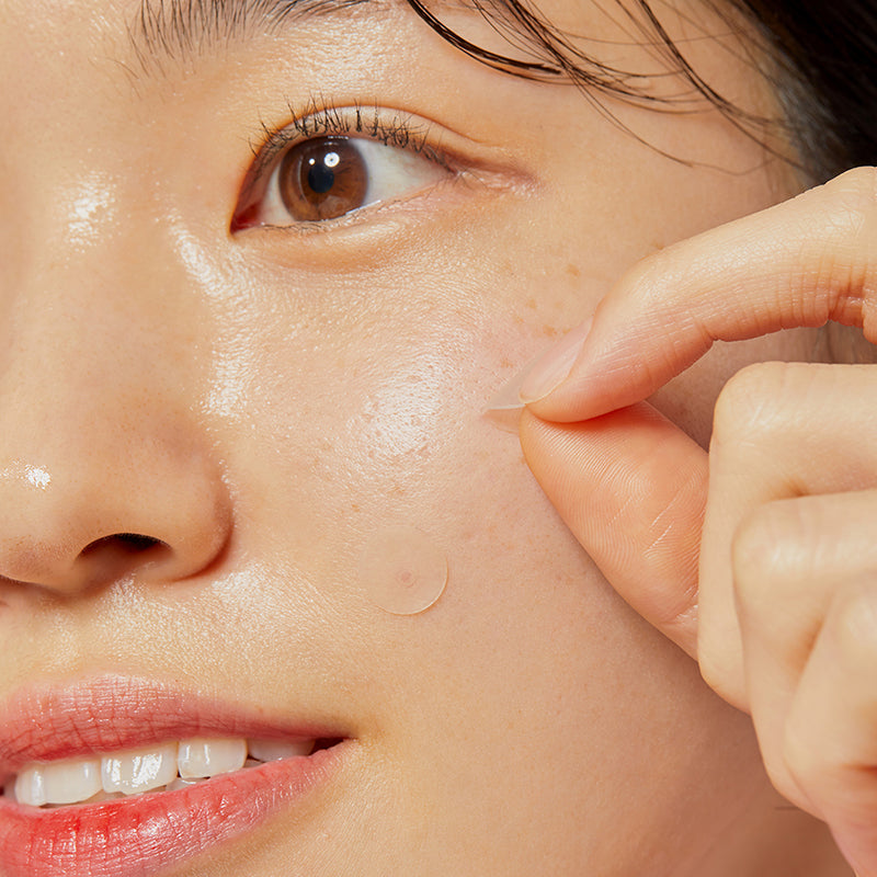 Acne Pimple Master Patches - koreanblossom