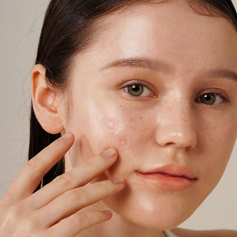 Onion Newpair Spot Patch Basic - koreanblossom