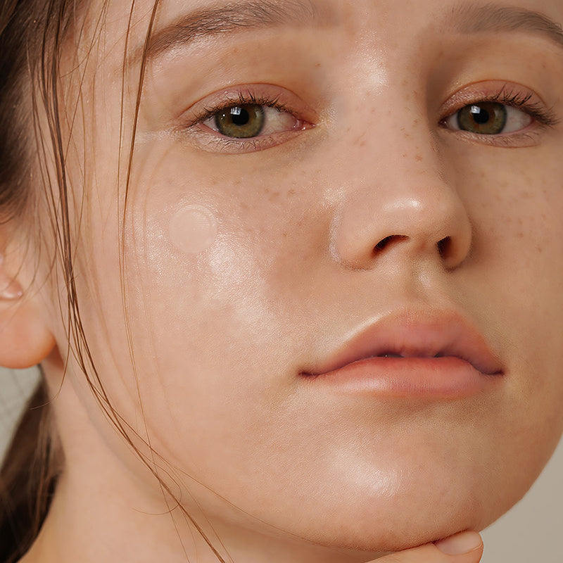 Onion Newpair Spot Patch Skin Fit - koreanblossom